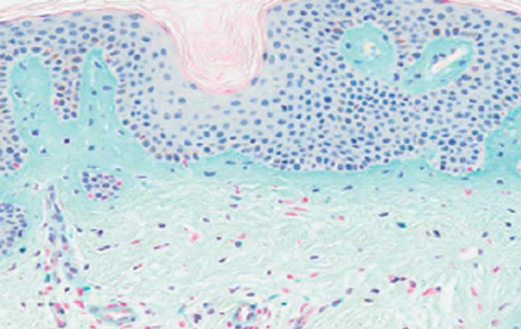 콜라겐 생성 촉진